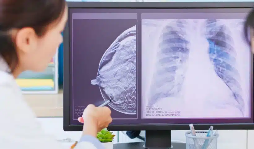 Les différents examens de diagnostic du cancer du sein